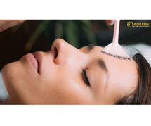 Get the Best Chemical Peel Treatment in Gurgaon