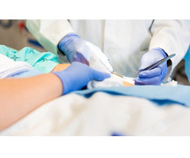 Who Are Wound Care Surgeons & Why You Need Them?