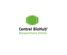 Human Saliva Samples | Order Biospecimens Online