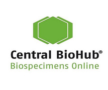 Allergy Samples for Research | Human Biospecimens | Order Online