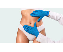 Achieve a Contoured Body With Liposuction Surgery