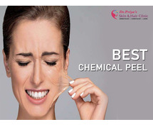 Best Chemical Peel Treatment in Marathahalli, Bangalore