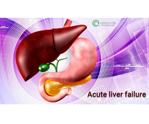 Stem Cell Therapy For Liver Damage