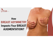 Breast Augmentation For Asymmetrical Breasts