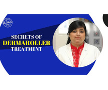 Top Doctor For Dermaroller Treatment In Delhi- Dr. Nivedita Dadu
