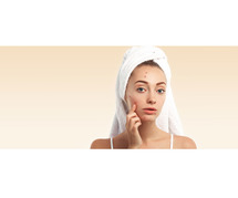 Skination Clinic - Effective Acne Treatment in Faridabad