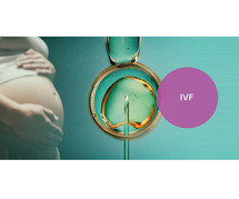 IVF Cost in Hyderabad | Best IVF Treatment in Hyderabad