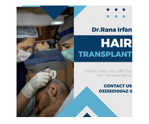 hair transplant service