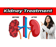 Dedicated to Kidney Health and Care: Nephrology Expert