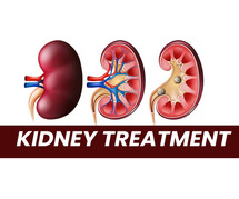 Advanced Methods for Diagnosing Chronic Kidney Disease