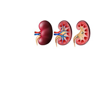 Kidney Stone Specialist in Delhi: Dr. Niren Rao You'll Ever Need
