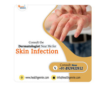 Consult the Dermatologist Near Me for Skin Infection