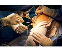 Arthroscopy Surgery Jaipur