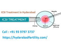 ICSI Treatment in Hyderabad