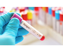 Explore Blood Test for Dengue