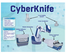 Cyberknife Centre in Meerut