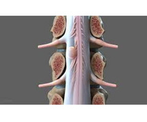Spine Tumor Treatment