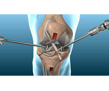 Knee Ligament Repair In Jaipur