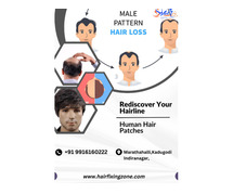 Rediscover Your Hairline: Human Hair Patches