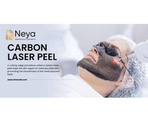 carbon laser peel treatment in hyderabad