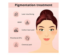 Pigmentation Treatment in Hyderabad