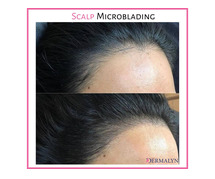 Microblading For Scalp Hair Loss