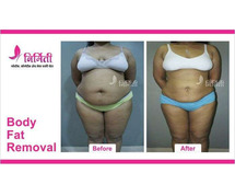 Body Fat Removal Treatment in Sangli