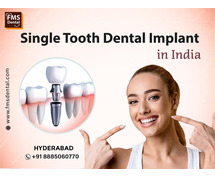 Best Dental Clinic in Jubilee Hills, Hyderabad, India| FMS Dental Hospital