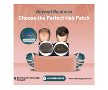 Beyond Baldness: Discover the Beauty of Hair Patches