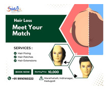 "Hair Loss, Meet Your Match: Non-surgical Hair Fixing"