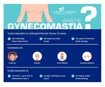 Gynecomastia Surgery Cost in Thane
