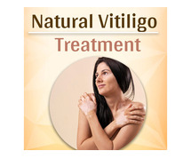 Home remedy for vitiligo treatment