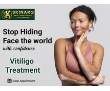 Vitiligo treatment in Pune | Best Vitiligo treatment Specialist | Skinarq