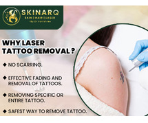 tattoo removal treatment in Pune | Best Tattoo removal treatments Specialist | Skinarq