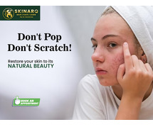 Laser Treatment For Acne Scars in Pune | Best Laser Treatment For Acne Scars Specialist | Skinarq