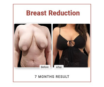 Breast Reduction Surgery in India | Dr. Amit Gupta