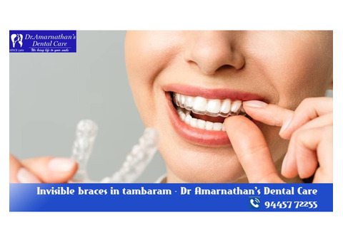 Invisible braces in tambaram - Dr Amarnathan's Dental Care