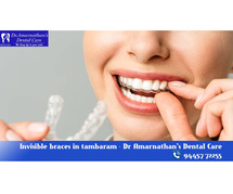 Invisible braces in tambaram - Dr Amarnathan's Dental Care