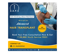 Best Hair Transplant in Delhi