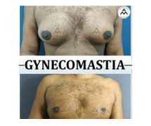 Gynecomastia/Male Breast Reduction Cost in Delhi, by Dr. Mrinalini Sharma