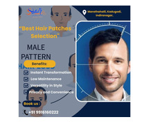 A Practical Guide to Dealing with Male Pattern Baldness