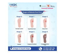Best Diabetic Foot Surgeon in Hyderabad | KBK Multi Speciality Hospitals