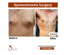 360 degree gynecomastia surgery in india – procedure & doctor