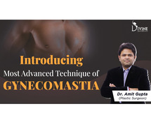 Advanced Technique of Gynecomastia | Dr. Amit Gupta