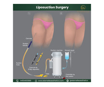 Liposuction surgeon in Hyderabad. Eternelle Aesthetics Is a Best Plastic Surgery Clinic