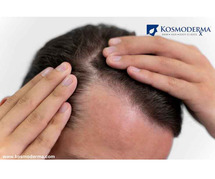 Alopecia Treatment | Hair Loss, Excessive Hair Fall due to Disorders in Bangalore