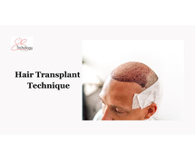 Hair Transplant Technique In Gurgaon