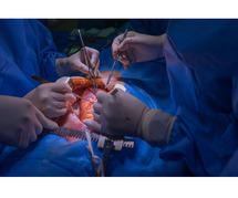 Learn about Heart Transplant Surgery in Delhi: Consult Dr. Sujay Shad