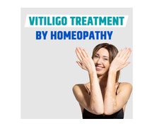 Unlocking Natural Solutions: Home Remedies for Vitiligo treatment