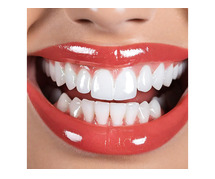ArcticGlow Teeth Whitening Best For Teeth